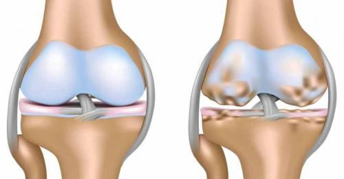 Artritis en gatos y perros: síntomas, diagnóstico y el tratamiento