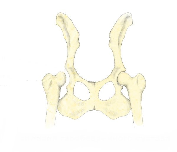 Displasia de cadera de perro: diagnóstico, tratamiento y pronóstico